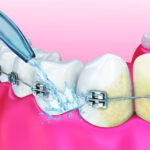 Irrigador Oral Veitsmile Water Jet