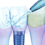 Irrigador Oral Veitsmile Water Jet