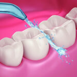 Irrigador Oral Veitsmile Water Jet