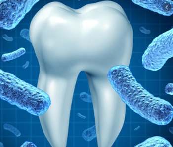 Doença Periodontal e Doença Cardiovascular