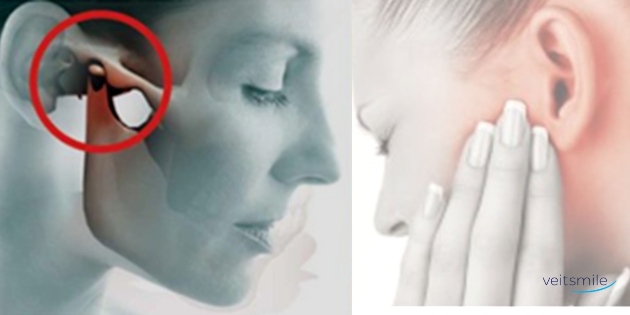 Minha mandíbula estala, isto é normal?