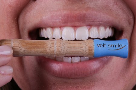 Irrigador Oral – Excelência para a saúde bucal