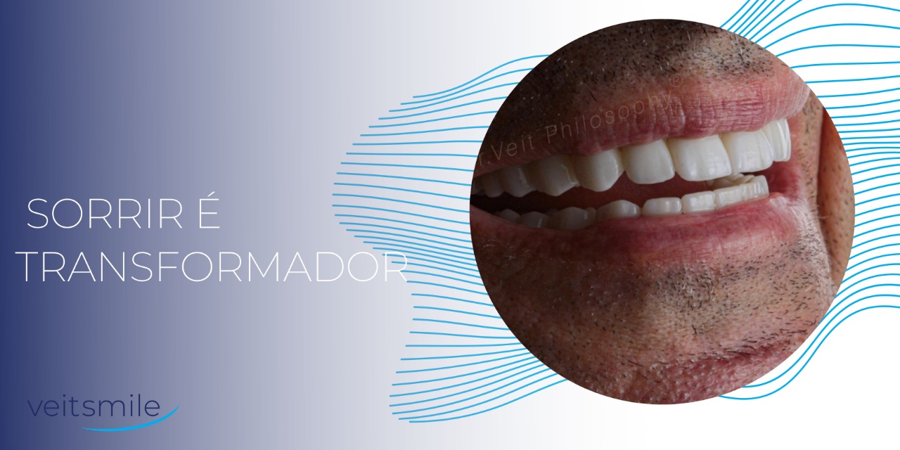 Como realizar uma boa escovação