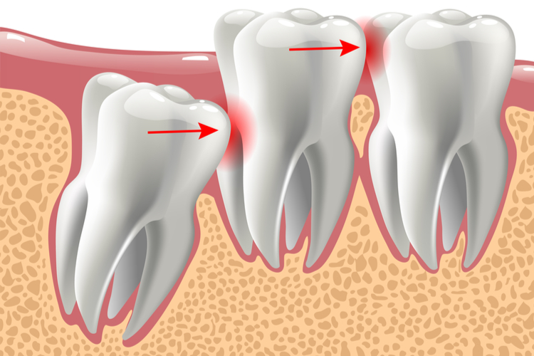 Você possui o dente do SISO?